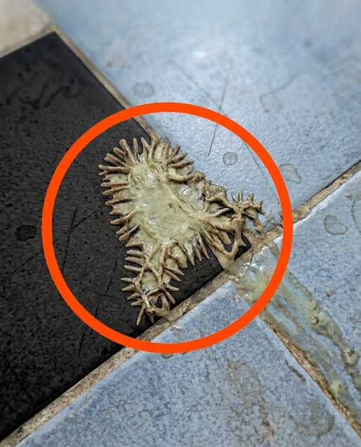 The Viral Bathroom Photo That Alarmed Thousands: What It Really Revealed About Moisture, Mold, and Home Maintenance