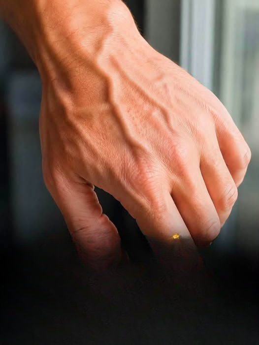 Why Are My Veins Suddenly More Visible or Prominent? Common Causes, What to Notice, and When to Seek Medical Advice