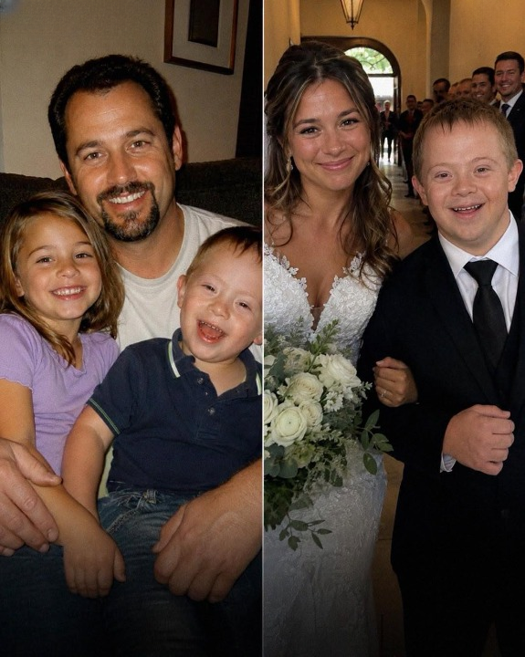 My Brother With Down Syndrome Offered to Walk Me Down the Aisle After Our Dad Passed Away, But My Future Mother-in-Law Cruelly Objected and Demanded I Cut Him From the Wedding Party—So I Secretly Ensured Her Worst Nightmare Came True in the Most Unforgettable Way Possible