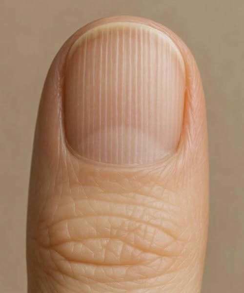 Do Lines or Ridges on Your Nails Mean Something About Your Health? Here’s What Those Changes Can Really Tell You and When It May Be Worth Asking a Doctor