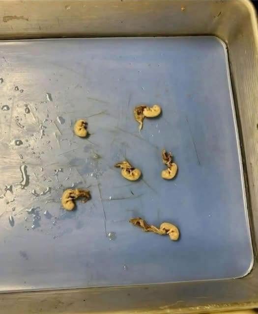 They Look Like Tiny Seeds, but Their Story Is More Interesting Than You Might Expect: A Closer Look at These Small and Often Misunderstood Foods