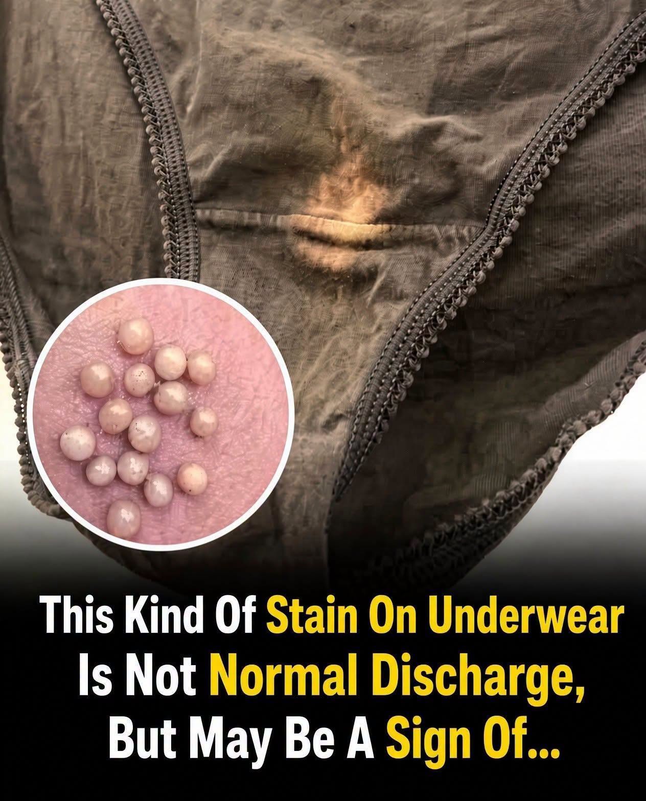 Underwear Stains: What May Be Normal and When to Speak With a Doctor