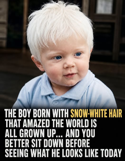The Boy With Snow-White Hair Who Captured Global Attention — What Happened to Him?