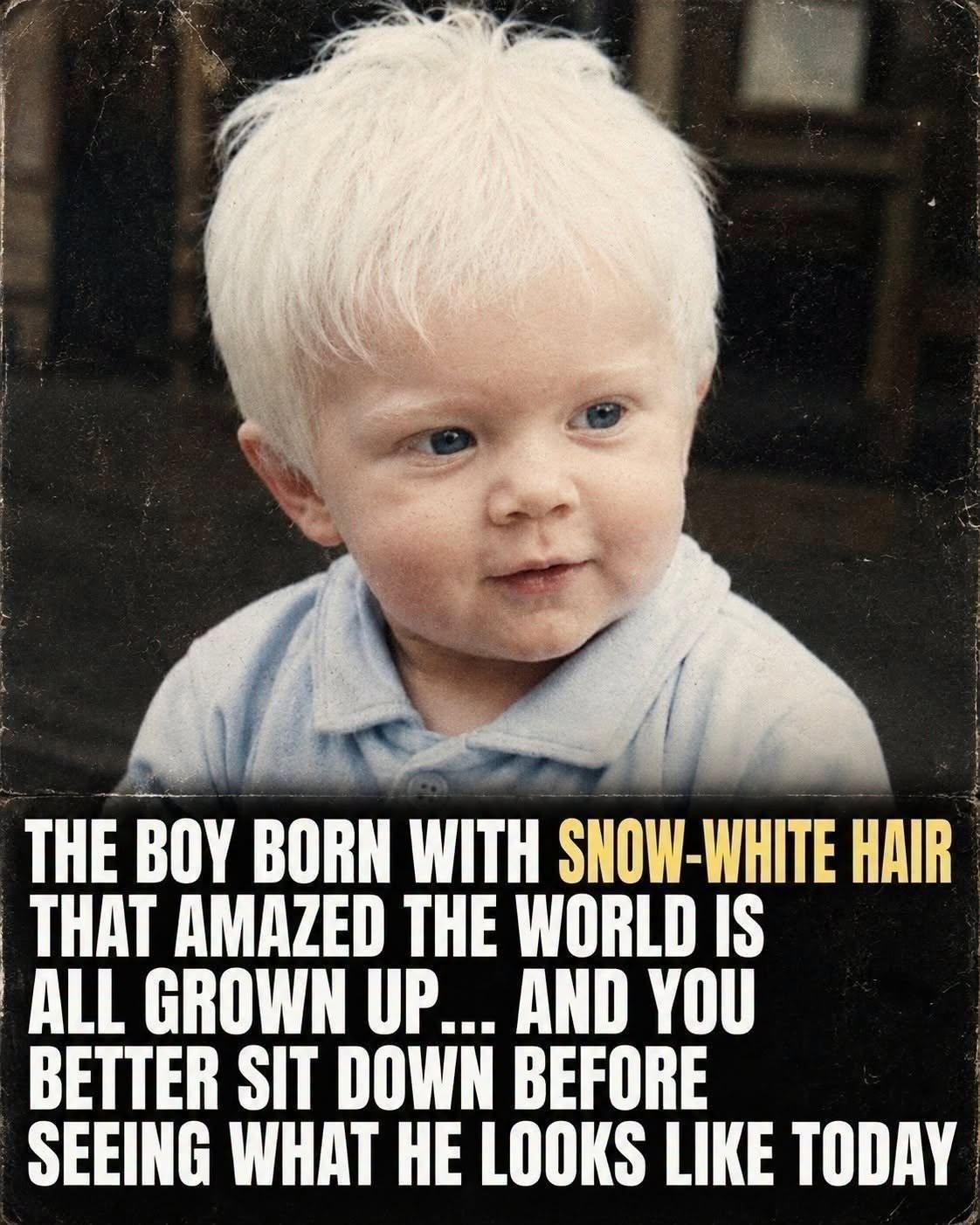 The Boy Born With Striking Snow-White Hair: His Extraordinary Childhood, How His Appearance Shaped His Journey, and What His Life Looks Like Today