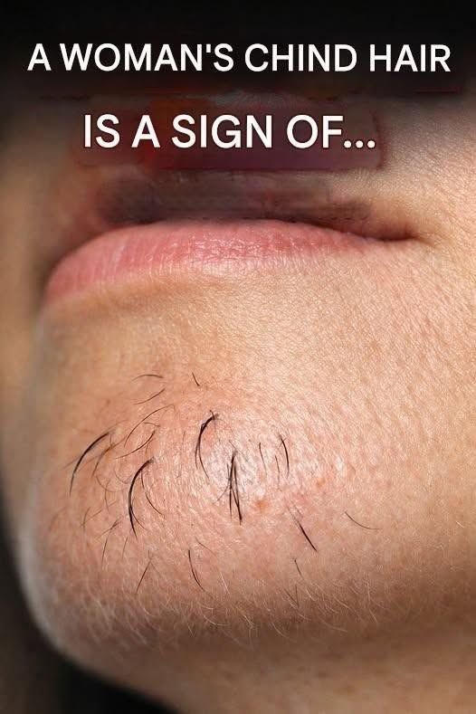 Noticing a Few Hairs on Your Chin? Here Are the Common Reasons It Can Happen and What Your Body May Be Telling You