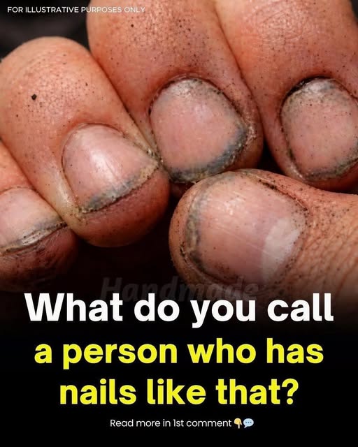 What Can the Appearance of Your Fingernails Really Tell You About Everyday Habits, Hygiene, Work, and General Nail Care?