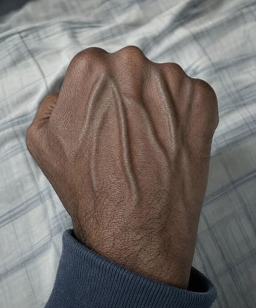 If the Veins on Your Hands Have Become More Noticeable Recently, Here Are Some Common Reasons They May Stand Out and What to Know