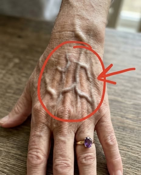 If Your Veins Are More Visible Than Usual, What Could It Mean? Understanding Common Causes, Normal Changes, and When Visible Veins Deserve Medical Attention