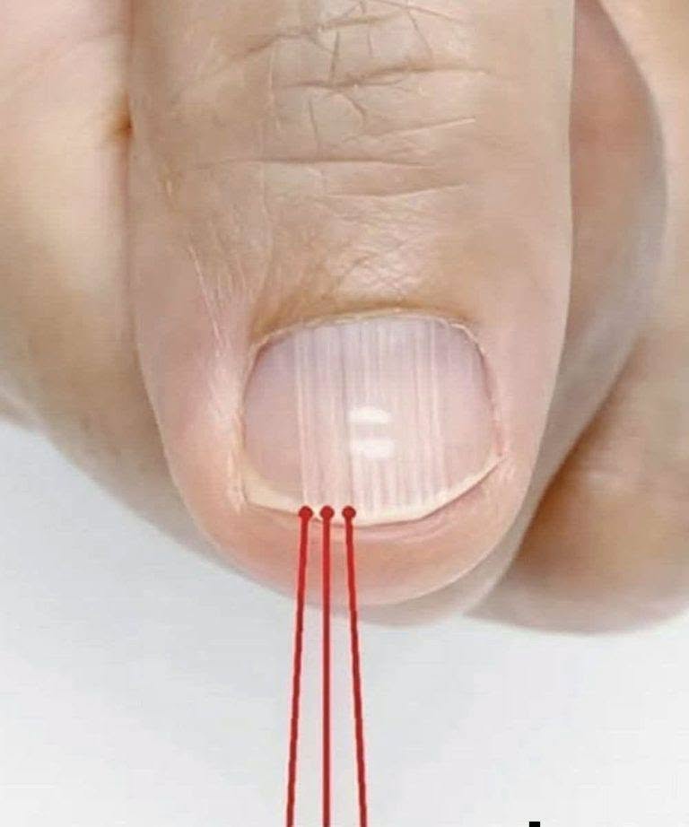 Noticed Lines or Ridges on Your Nails After 40? What These Common Nail Changes Can Mean, What Is Usually Normal, and When They Deserve Medical Attention