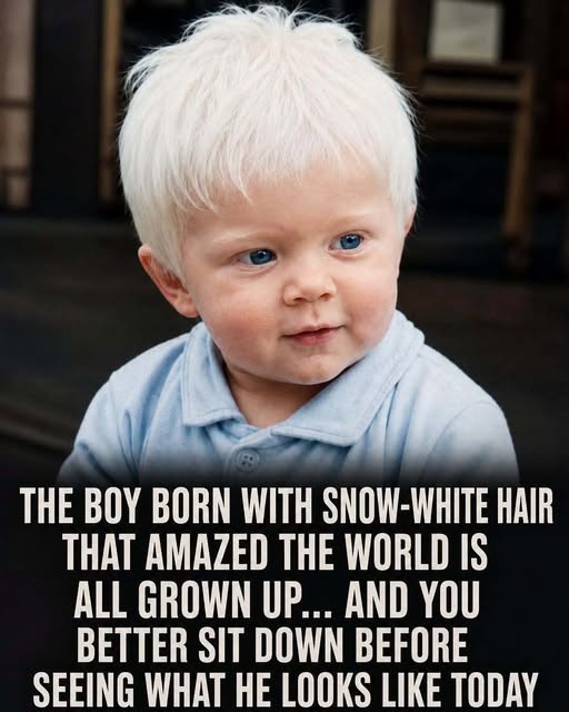 Beyond the Viral Photos: The Story Behind the Boy With Snow-White Hair