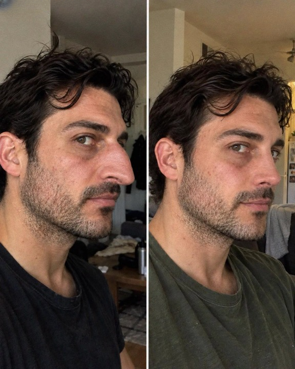 I Used My Savings to Help My Husband Finally Get the Surgery He Had Always Wanted, but What I Discovered in an Old Photo Album Made Me Question Why He Had Changed His Appearance