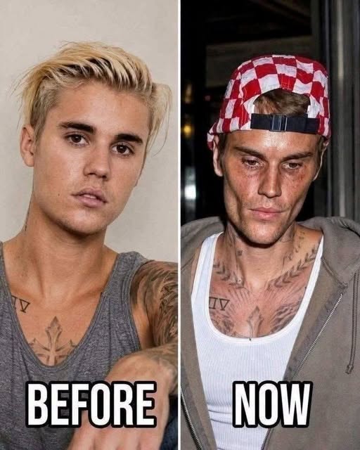 Justin Bieber Opens Up About His Lyme Disease Diagnosis and Health Journey